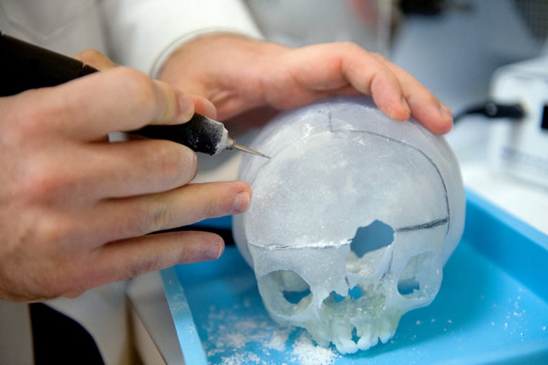 Как хирурги Бостонского госпиталя применяют 3D- печать для подготовки к операции