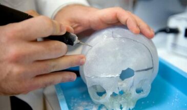 Как хирурги Бостонского госпиталя применяют 3D- печать для подготовки к операции