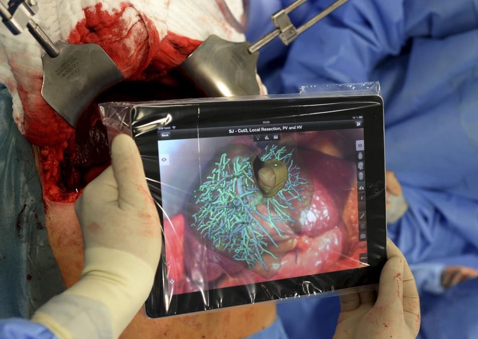 Удаление опухоли печени с использованием AR (фото: www.ibtimes.sg)