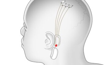 Проект Илона Маска Neuralink может начать испытания на человеке уже в следующем году