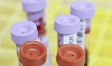 Терапия, которой уже больше века, превратилась в новый способ борьбы с COVID-19