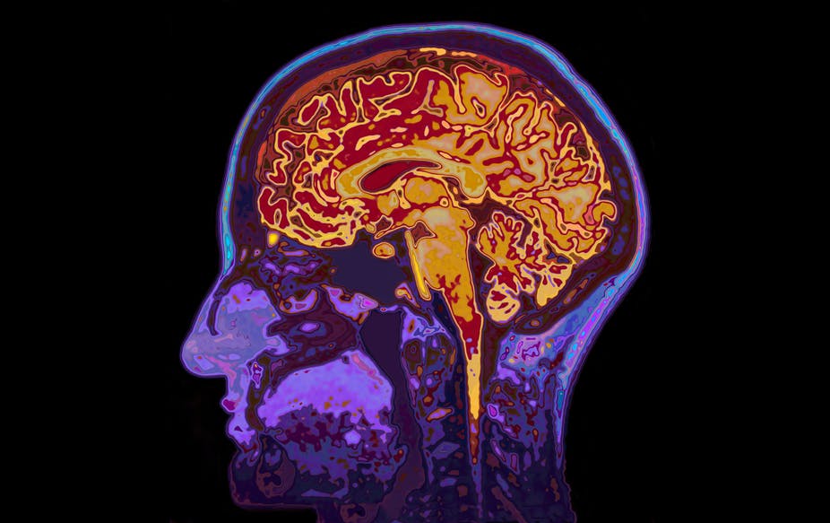 Пять удивительных фактов о человеческом мозге 