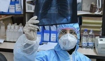Медики выяснили, что коронавирус вызывает разрушительную иммунную реакцию