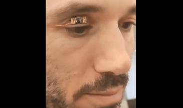 В Blink Energy создали батарею, которая заряжает смарт-линзы сквозь веко