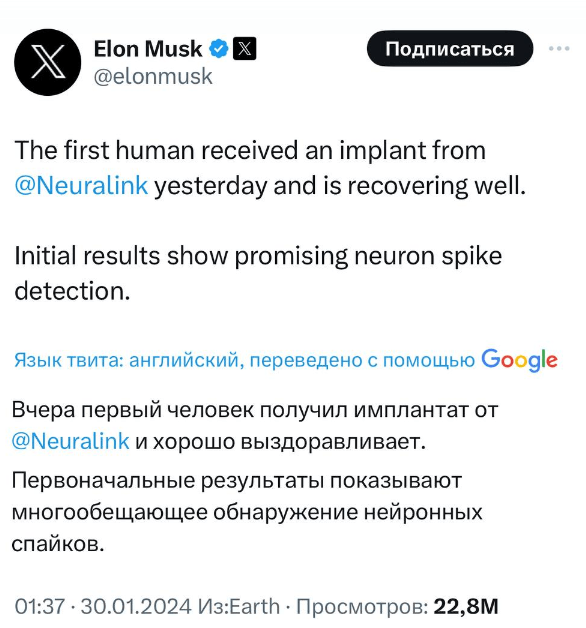Neuralink Илона Маска успешно вживила нейрочип