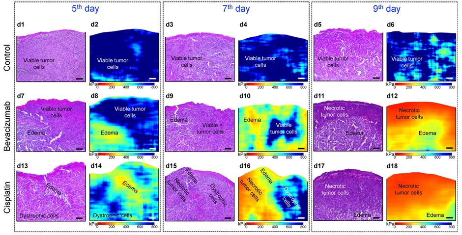 Nature, Histological validation of in vivo assessment of cancer tissue inhomogeneity and automated morphological segmentation enabled by Optical Coherence Elastograph