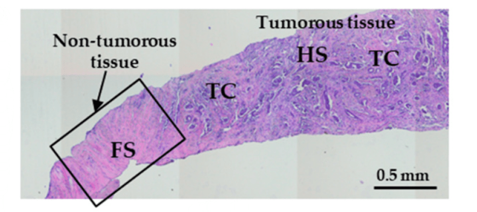 MDPI, Diagnostic Accuracy of Cross-Polarization OCT and OCT-Elastography for Differentiation of Breast Cancer Subtypes: Comparative Study