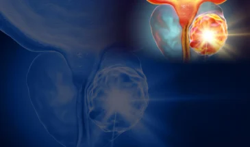 Команда урологов Сеченовского Университета впервые в мире провела мета-анализ ИИ-ресурсов для генетического профилирования рака простаты